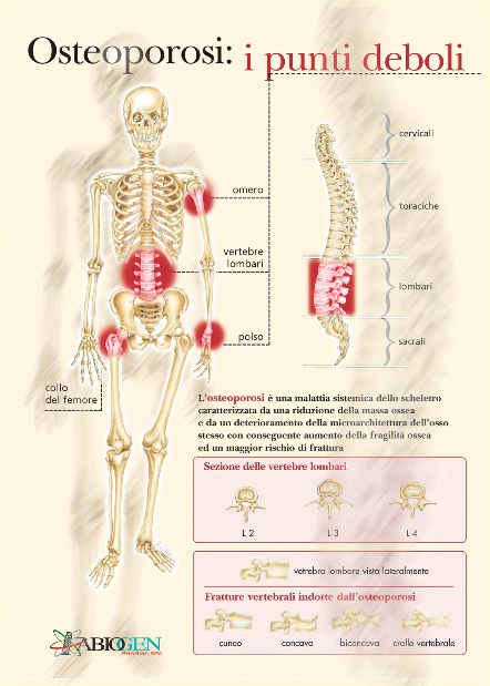 osteoposter.jpg