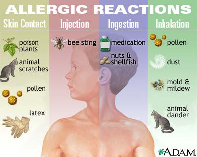 reazioni-allergiche.jpg