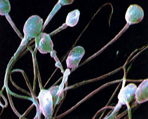 1213sperm475.jpg