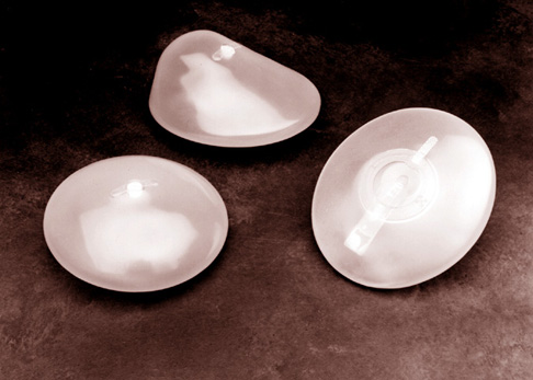 implants1.jpg