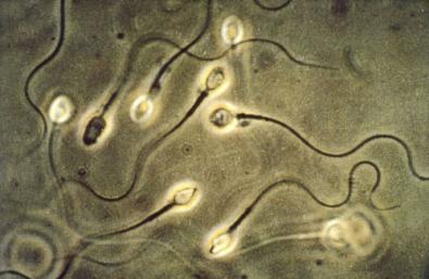 spermatozoi.jpg