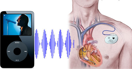 e-vero-che-gli-ipod-interferiscono-con-i-pacemaker-foto.jpg