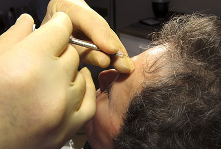 il-botox-potre-diff-al-sn.jpg