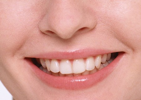 denti-belli