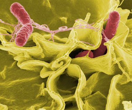 salmonella-contro-il-cancro