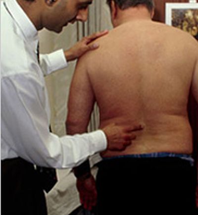 sciatica1
