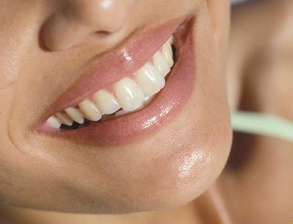 denti-e-gengive-nuove