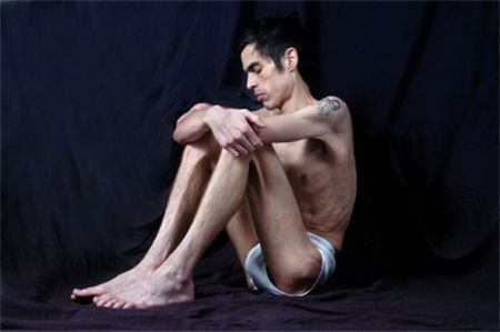 uomo-anoressico