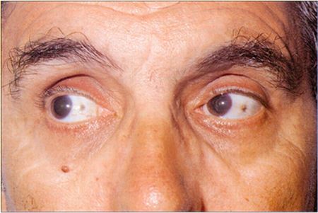 A quello che la macchia scura su una faccia sogna