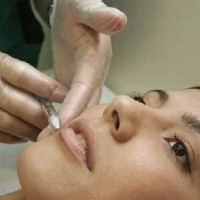 microneedling microneedling