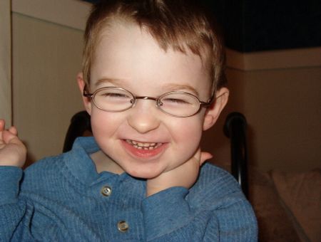sindrome di angelman