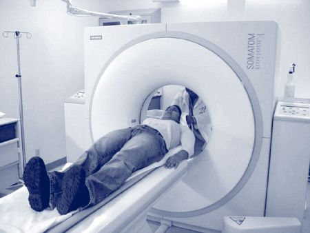 Un nuovo test individua il rischio enfisema nei fumatori