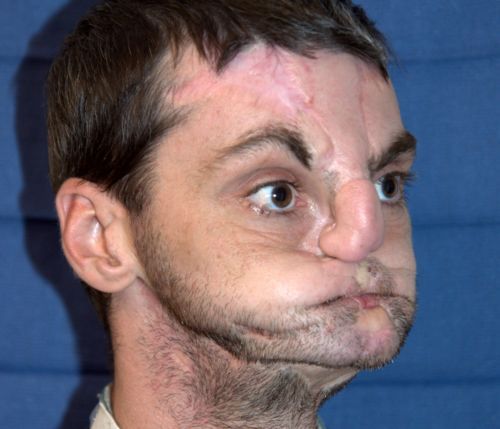 Mettere maschere a una faccia