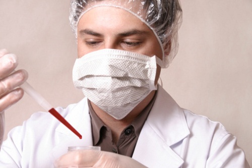 sindrome down scoperto gene fattore rischio leucemia