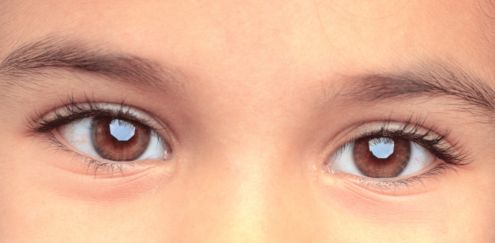 retinoblastoma cure brachiterapia