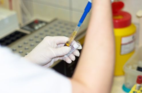 donazione organi