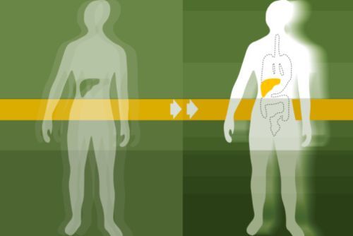 donazione organi
