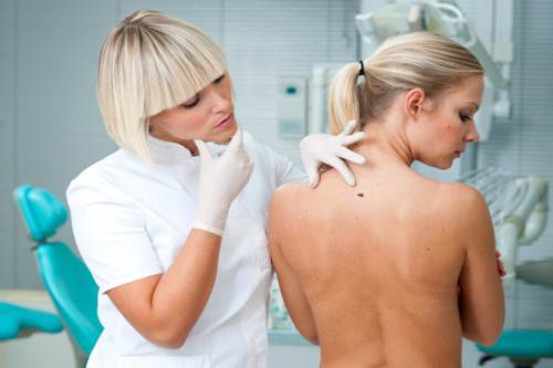 tumore pelle prevenzione aspirina
