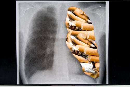 prevenzione malattie respiratorie giovani fumatori spirometria