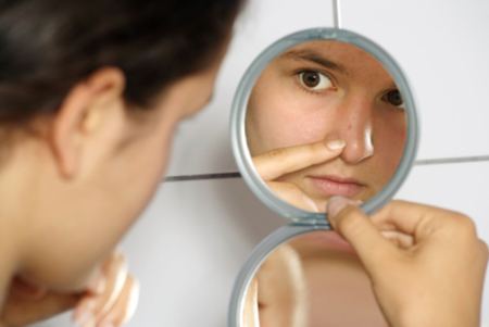 Acne giovanile cistica tardiva cause cure rimedi
