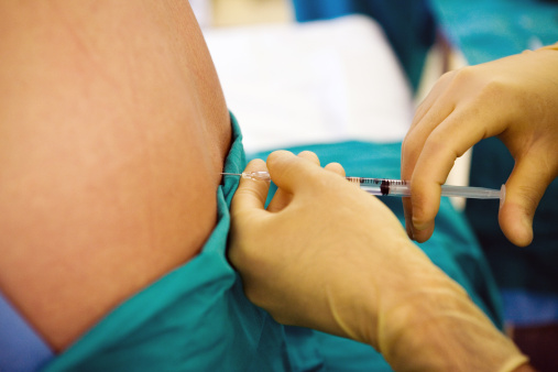 epidurale partorire