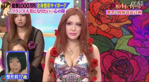 chirurgia estetica giapponese francese foto video