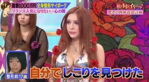 chirurgia estetica giapponese francese foto video