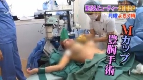 chirurgia estetica giapponese francese foto video