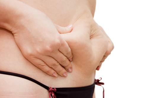 7 cose sapere cellulite vero falso FOTO