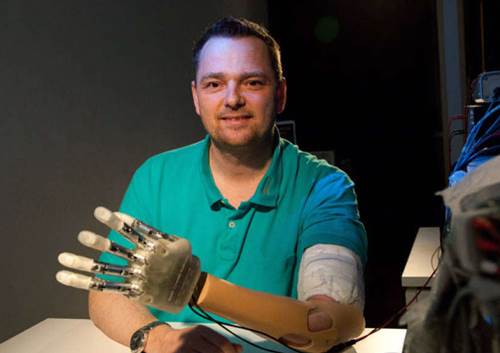 prima mano bionica "sente" oggetti