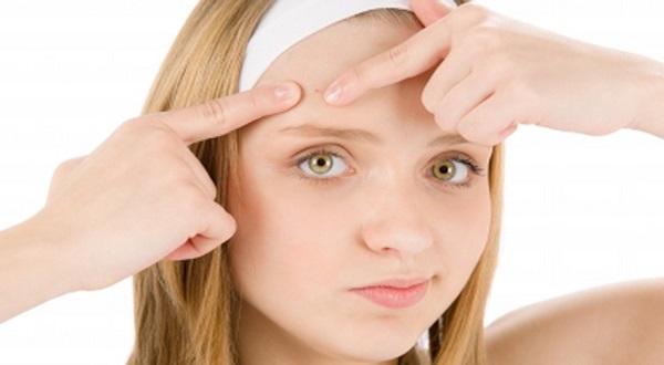 10 consigli combattere acne estate