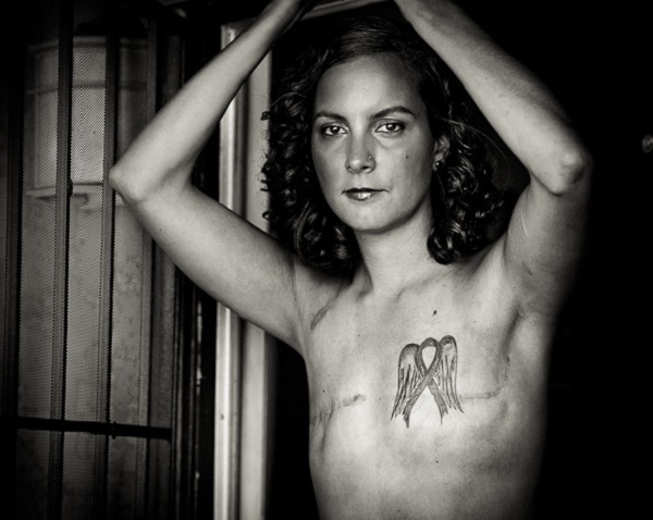 Donne operate seno: foto The Scar Project