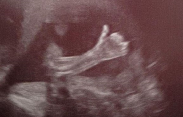 bambino da ok pancia mamma