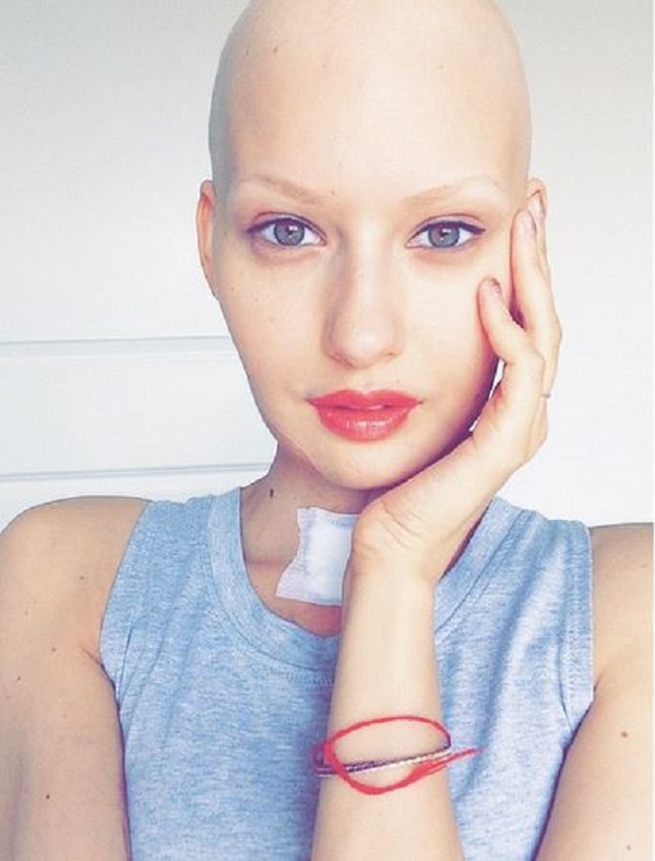 elizaveta bulokhova modella sfida tumore social