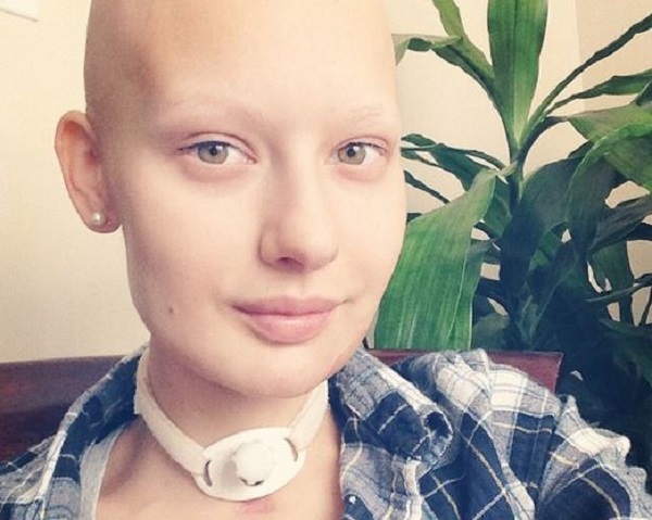 elizaveta bulokhova modella sfida tumore social