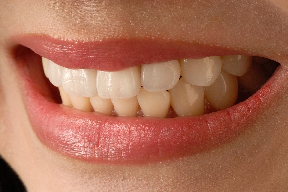 cura dei denti